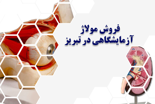 مولاژ آزمایشگاهی در تبریز